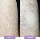 Depilação Suave - Crystal Hair Eraser™